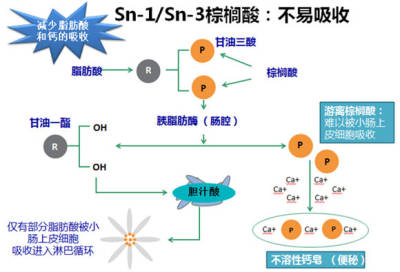 SN-2 PLUS能减少游离棕榈酸