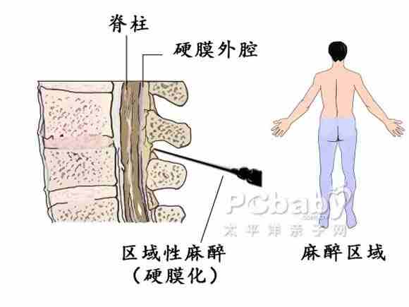 剖腹产全过程，看哭了！